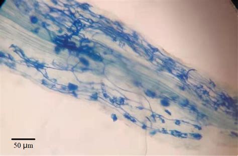 Glomus Mosseae Colonization Characteristics In The Roots Of Alfalfa Download Scientific Diagram