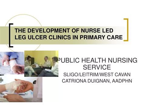 Ppt The Development Of Nurse Led Leg Ulcer Clinics In Primary Care