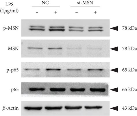 Msn Silencing Reversed Lps Induced Inflammatory Cytokine Production And