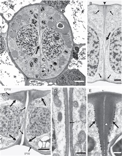 Figure 1 from The role of callose in guard-cell wall differentiation ...