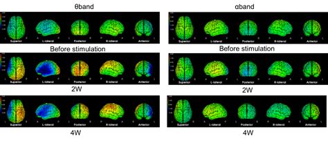neuronal activity topography reveals neuronal change  comatose