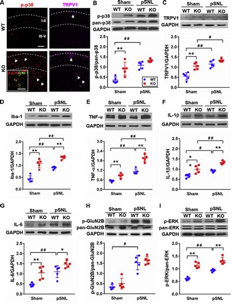 Adiponectin Regulates Thermal Nociception In A Mouse Model Of