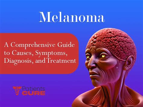 Melanoma A Guide To Causes Symptoms Diagnosis Treatment