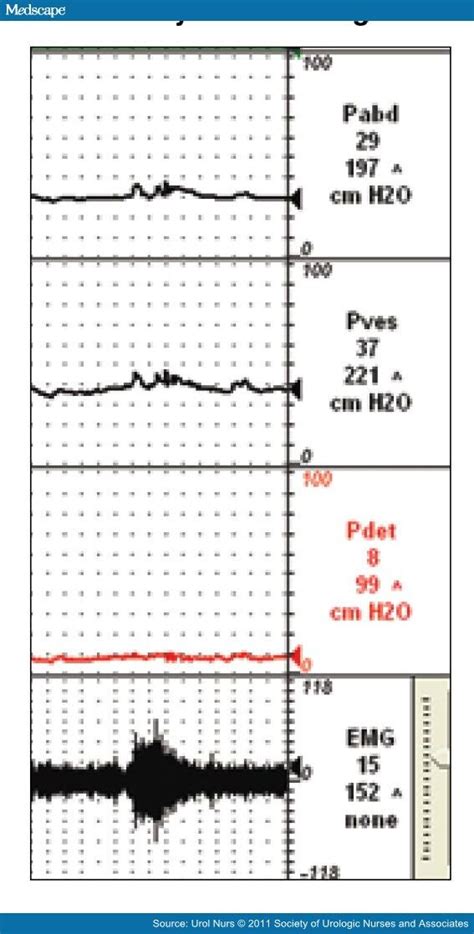 Electromyography Of The Pelvic Floor Muscles