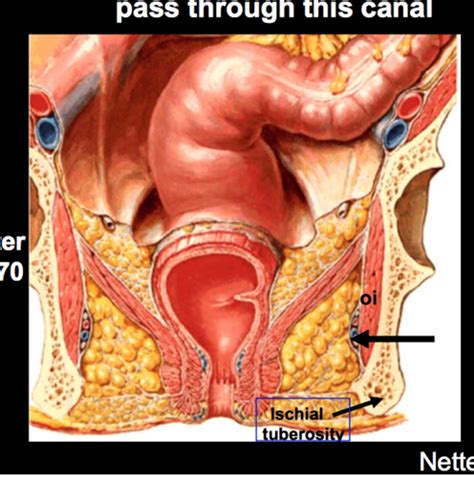 Practical 4 Pelvis And Perineum Flashcards Quizlet