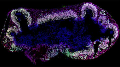 Cerebral Organoids Provide Insight into Human Brain Development and ...