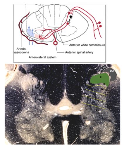 Exam Pain Modulation And The Thalamus Flashcards Quizlet