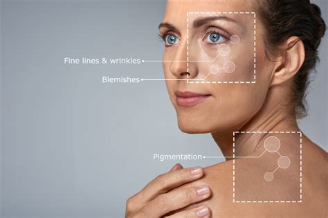 Dr Sean Doherty Laser Skin Procedures In Boston And Brookline Ma