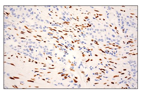 Zeb E G Y Xp Rabbit Mab Bsa And Azide Free Cell Signaling