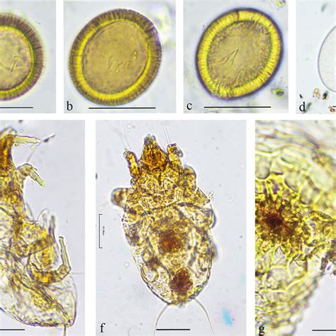 Parasites Found In Coprolites A C Taeniid Eggs D Possible Helminth Download Scientific