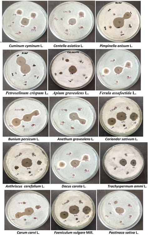 Profiling Of Antifungal Activities From The Leaf Extract Of Selected