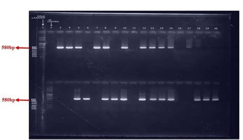 2 Agarose Gel Electrophoresis Analysis Of Pfcrt Gene At Snps Codon Download Scientific Diagram