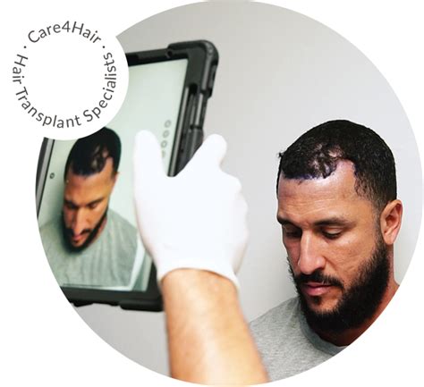 NeoGraft Hair Transplant - Automated FUE | Care4Hair