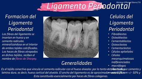 Ligamento Periodontal Mariana Villarreal Ibarra Udocz