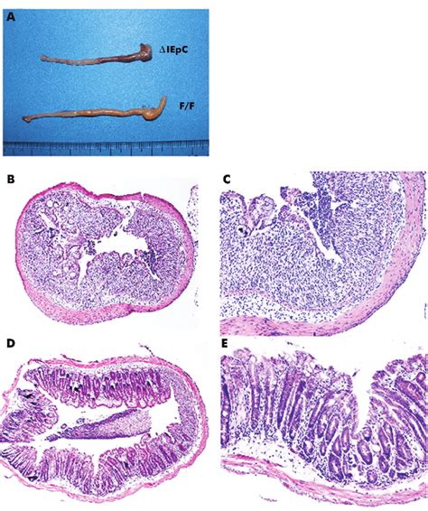 Macroscopic And Histological Findings In Mice With Intestinal