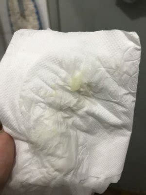 Corrimento Talhado Branco Sem Cheiro - Corrimento esverdeado sem cheiro.. o que pode ser? | BabyCenter