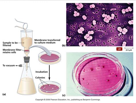 Assessment Of Microbial Contamination And Spoilage