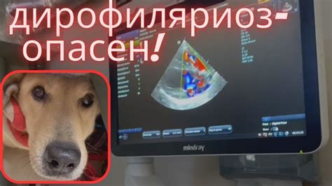 Дирофиляриоз/черви в сердце/лечение у кардиолога - YouTube