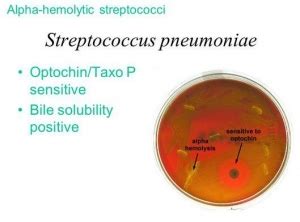 Taxo P Optochin Discs by Healthlink | Medline Industries, Inc.