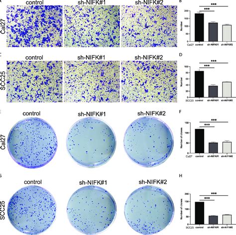 Nifk Promotes Tumor Cell Proliferation And Metastasis In Hnscc A