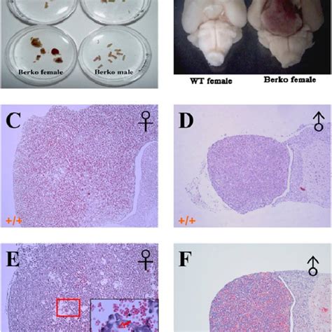 Immunohistological Analysis Of Pituitary Tumors Serial Sections Of