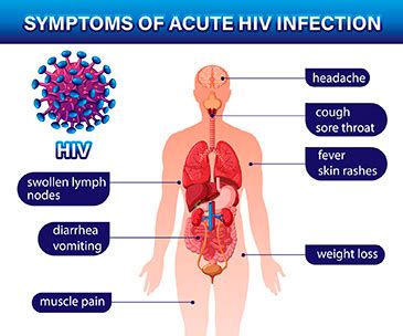 Can Hiv Cause Swollen Lymph Nodes - Infoupdate.org