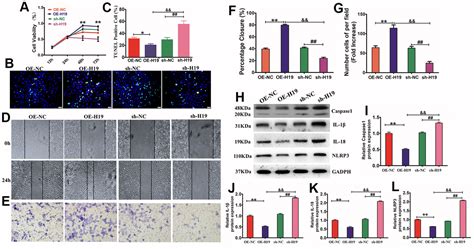 Hair Follicle Mesenchymal Stem Cell Exosomal Lncrna H Inhibited Nlrp