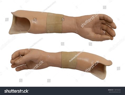 2,599 Prosthetic Arm Medical Images, Stock Photos, 3D objects ...