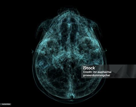 Human Skull Brain By Ct Scan Xray Visualization Inside Of Skull 3d Illustration Render Stock