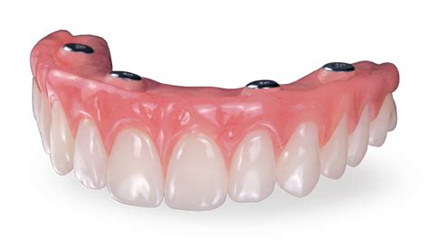 Berkshire Dental Health Denture Stabilization In Pittsfield