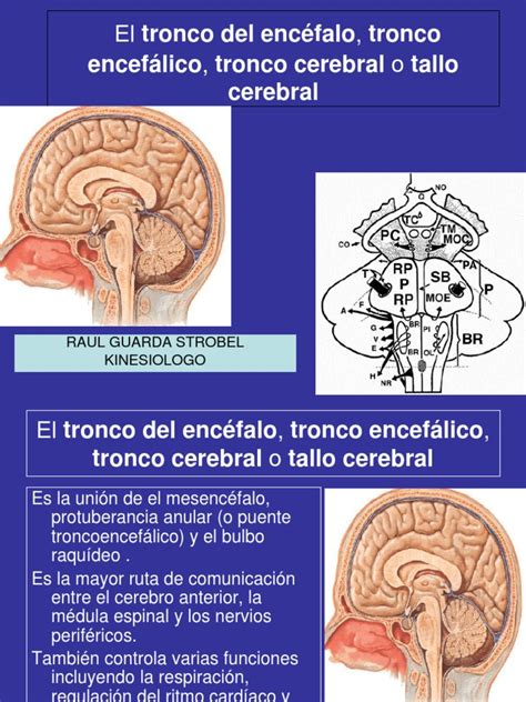 Tronco Encefalico 2 Pdf Tronco Encefálico Órgano Anatomía