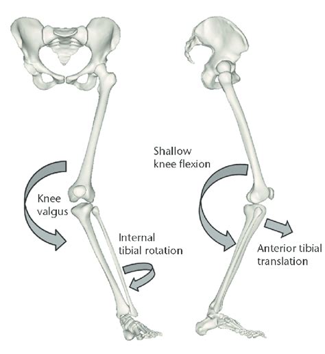 Knee Ligamentous Injuries Robert Fronjian