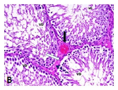 A Photomicrograph Of The Testis Of Control Rat Showing Normal Download Scientific Diagram