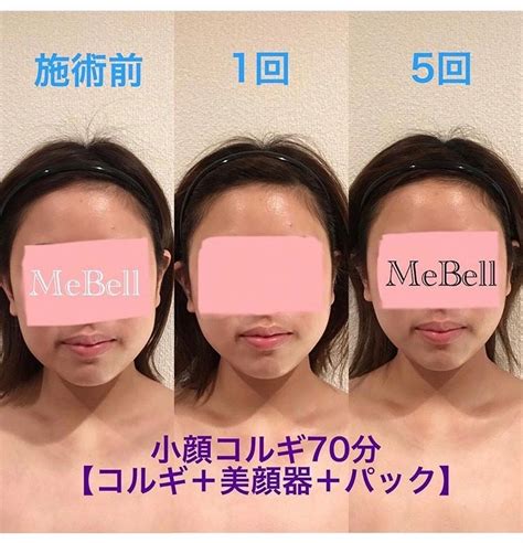 【小顔コルギ】効果はどのくらい？ 小顔コルギ＆美肌改善フェイシャルサロン 「mebell～ミベル～」福岡 大名