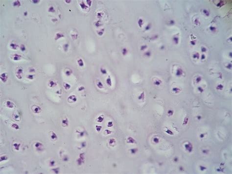 Hyaline Cartilage Histology