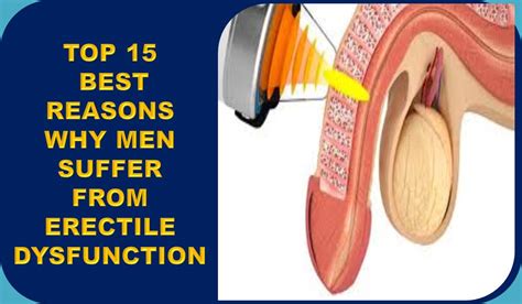 Clickerraw TOP 15 BEST REASONS WHY MEN SUFFER FROM ERECTILE