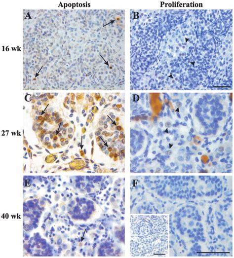 TUNEL Assay A C And E And Immunohistochemistry Of Ki 67 Protein B