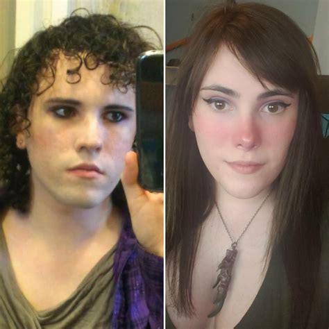 6 Month Pre Hrt Vs 6 Year Post Hrt Ffs R Transtimelines