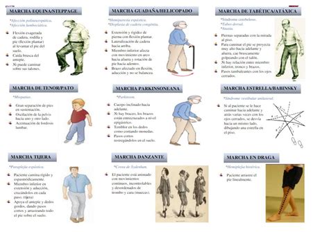 Marchas Patol Gicas Descripci N Graficas De Las Mas Frecuentes Vistas