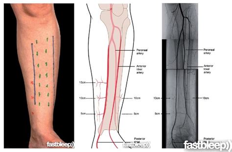 Pin by Tammy Smith on NS - Pediatrics | Pinterest