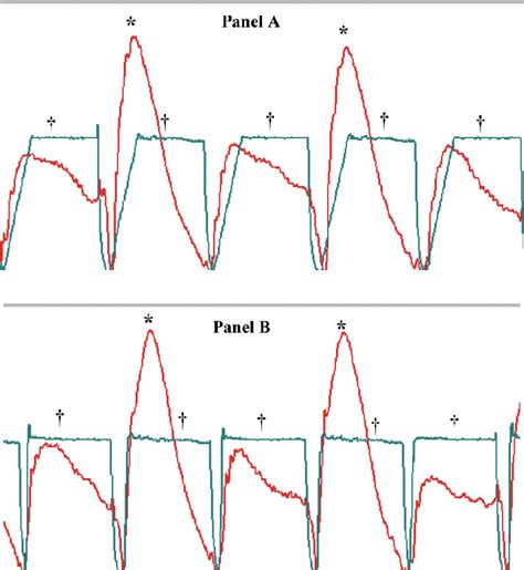 Figure 2 From The Biodex Isokinetic Dynamometer For Knee Strength