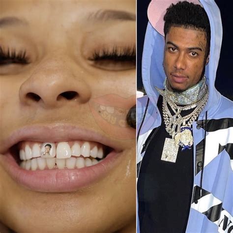 Ground Up Buzz — Chrisean Rock Gets Tooth Implant With BlueFace's...