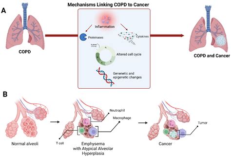 Cancers Free Full Text Multifactorial Diseases Of The Heart