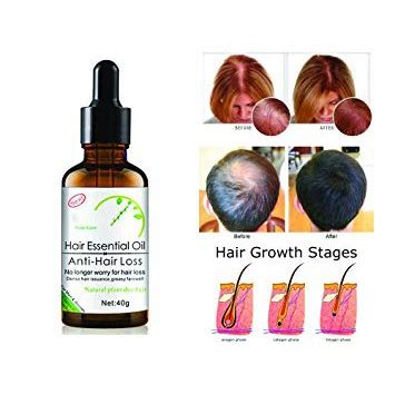 Disaar ORGANIC PLANT EXTRACT FAST Hair Growth Essential Oil BLACK BOX