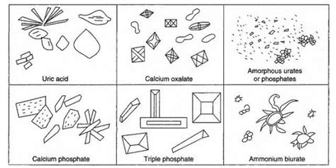 Urine Crystals Forms | Medical Laboratories