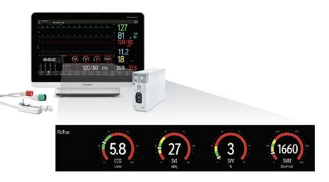 Mindray S Benevision N Series To Integrate With Edwards Flotrac Sensor