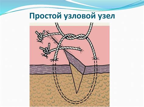 Простой узловой узел - online presentation