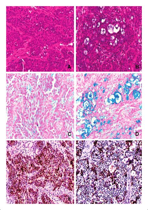 Immunohistochemical Staining In Bxpc Tumor Xenografts Bxpc