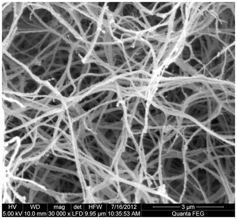 Scanning Electron Microscopy Fibrin Clots From Age And Sex Matched Download Scientific