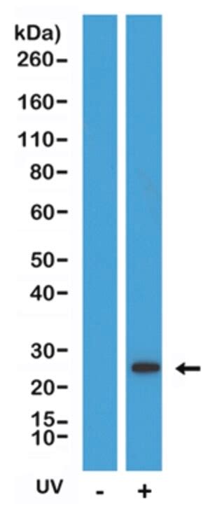 Caspase 8 Colorimetric Activity Assay Kit 25 IETD Caspase 8